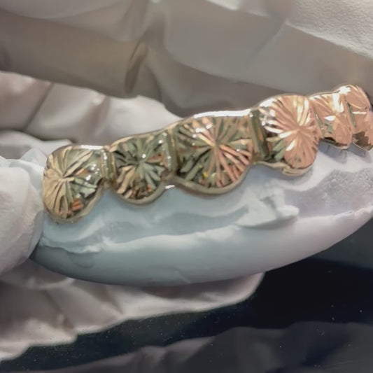 10K Yellow Gold 6 Piece Pull outs Grillz